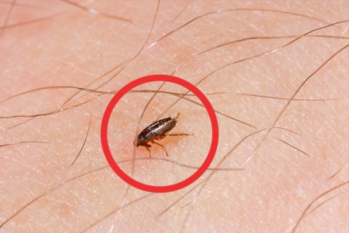 Nahaufnahme eines Flohs auf der Haut